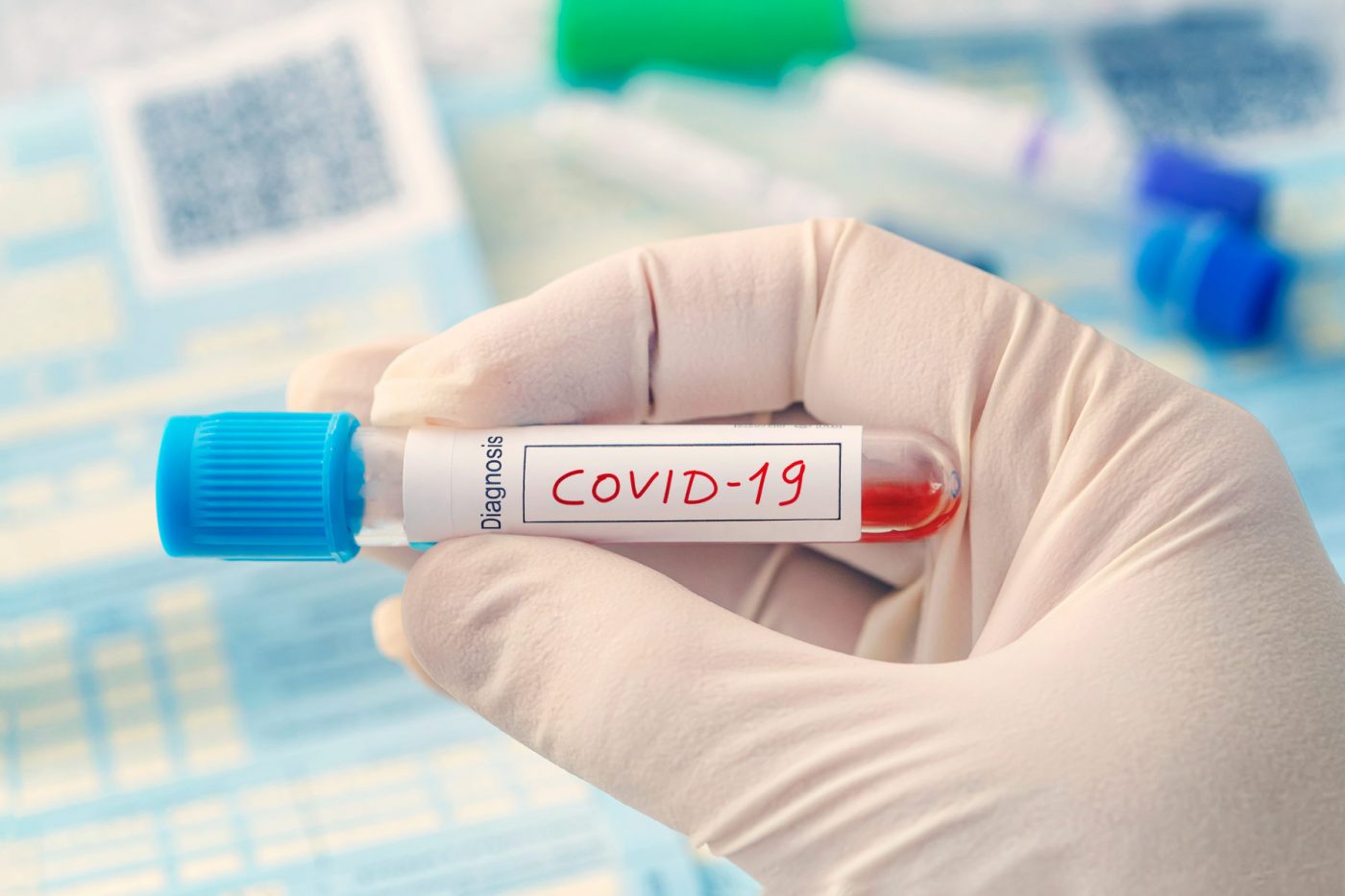 Il coronavirus è clinicamente morto?